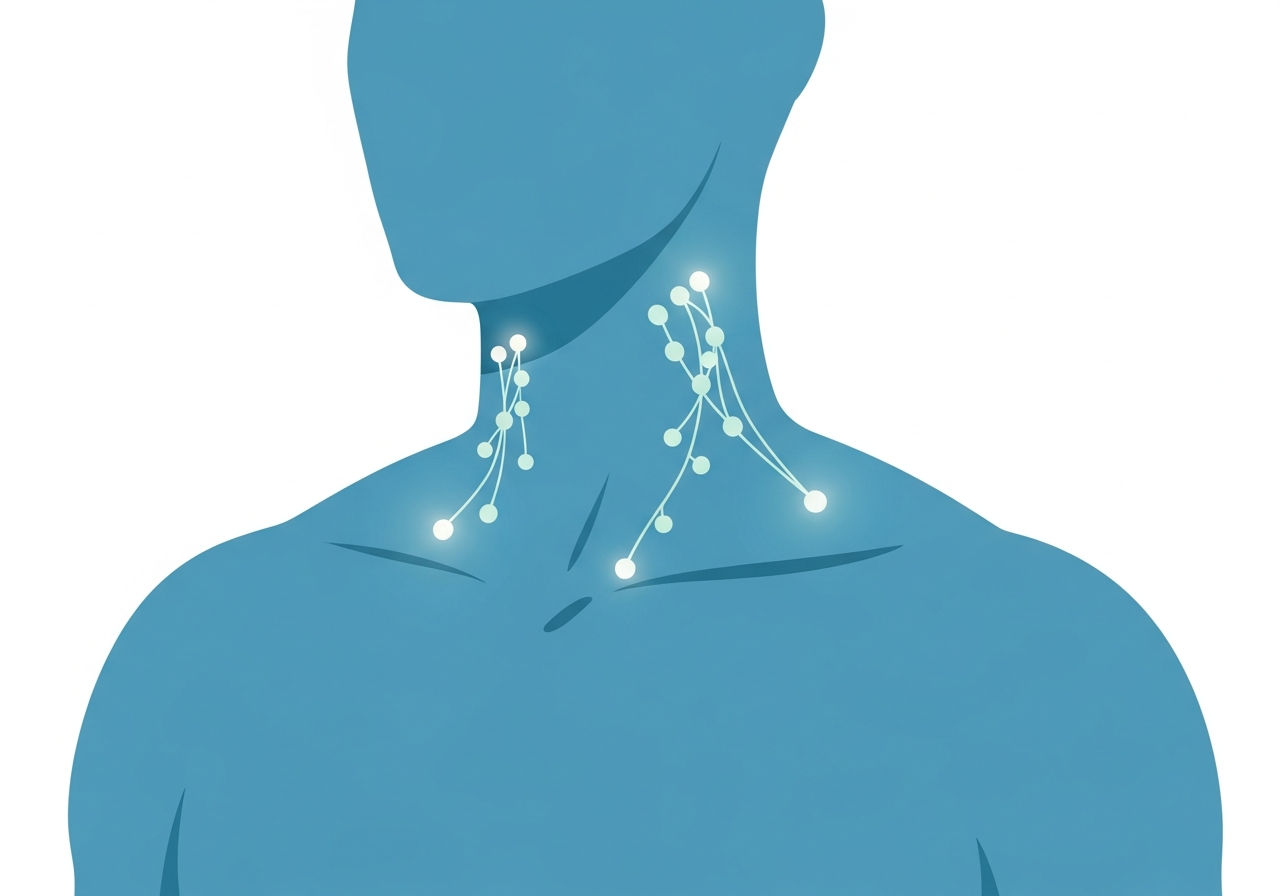 Swollen Lymph Nodes and Leukemia — medical illustration