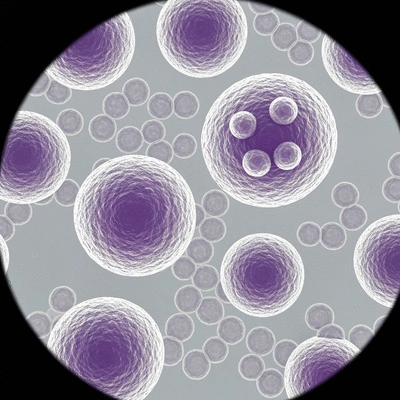 Microscopic view of leukemia cells, showing abnormal white blood cells, no text, no words, no typography, 8K